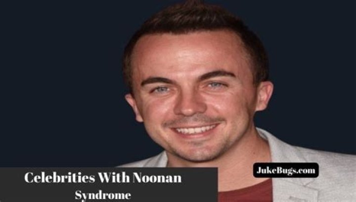 10 Celebrities With Noonan Syndrome