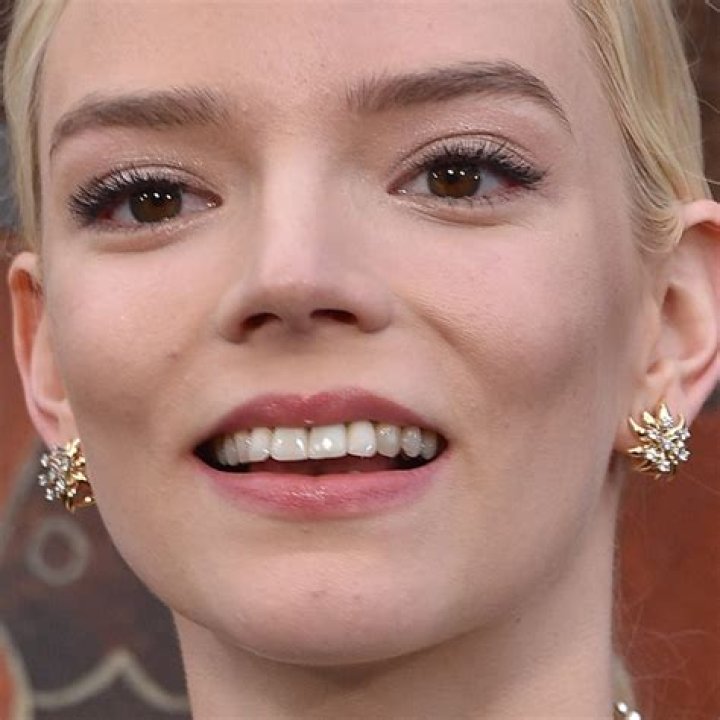 Anya Taylor-Joy's Teeth Accident: Uncovering The Untold Story