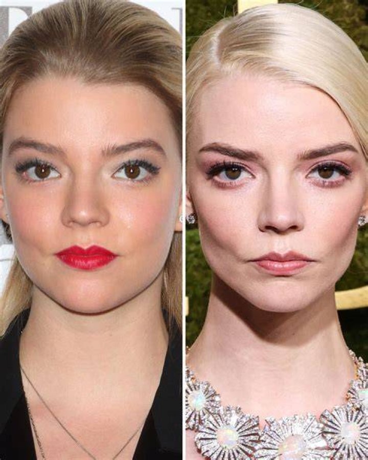 Anya TaylorJoy Before And After The actress, who stands at 5ft