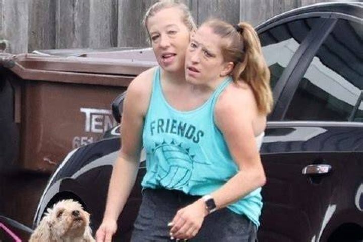 Are Abby And Brittany Hensel Married All You Need To vrogue.co
