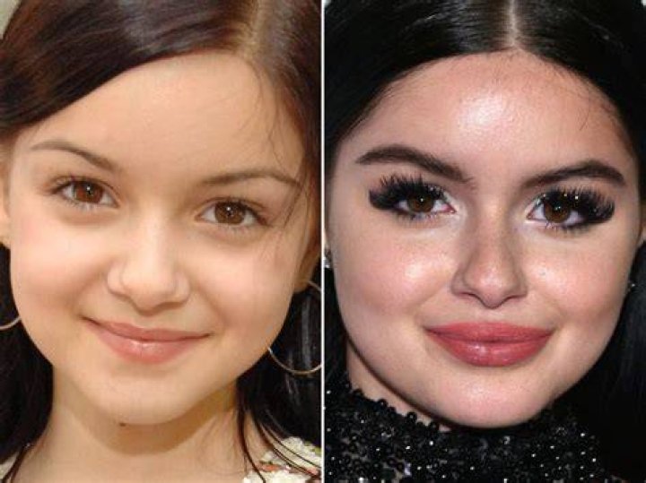 Ariel Winter’s Before and After Breast Reduction Photos Show How Happy