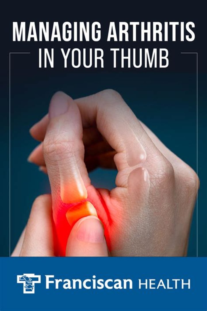 Arthritis at the base of the thumb Hand Therapy Group