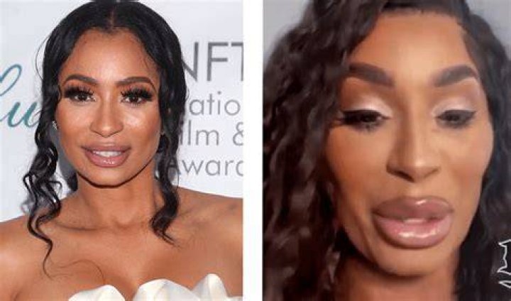 Black America Responds To Karlie Redd’s New Look And Trends In Plastic