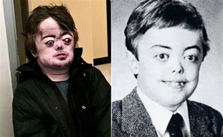 Brian Peppers: A Life Shaped by Disorder and Controversy