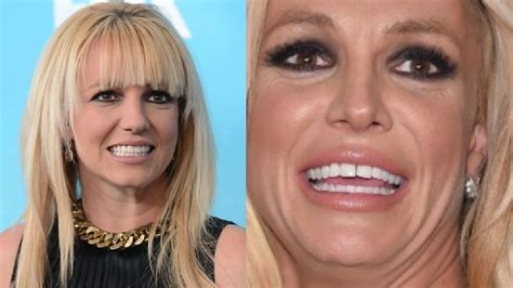 britney spears teeth père de britney spears Genertore2