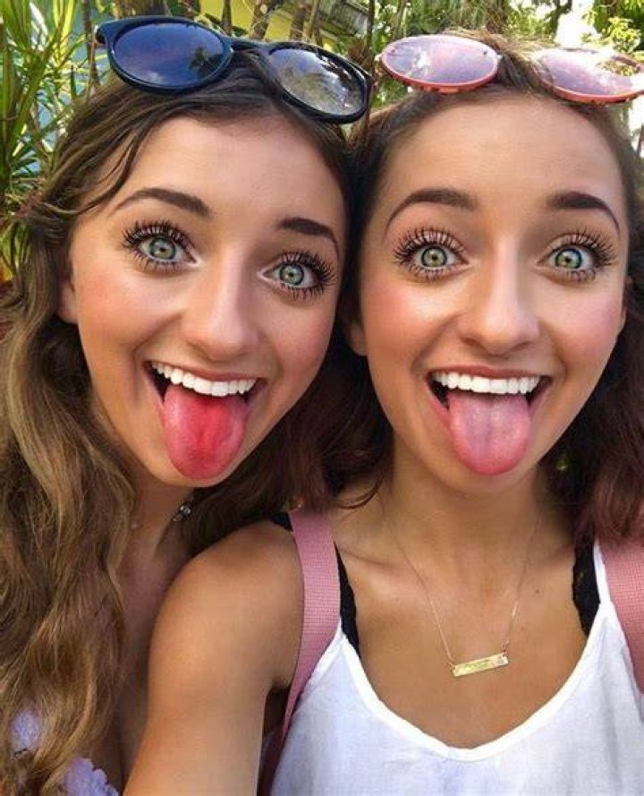 Brooklyn And Bailey Before And After Nose Job Job Retro