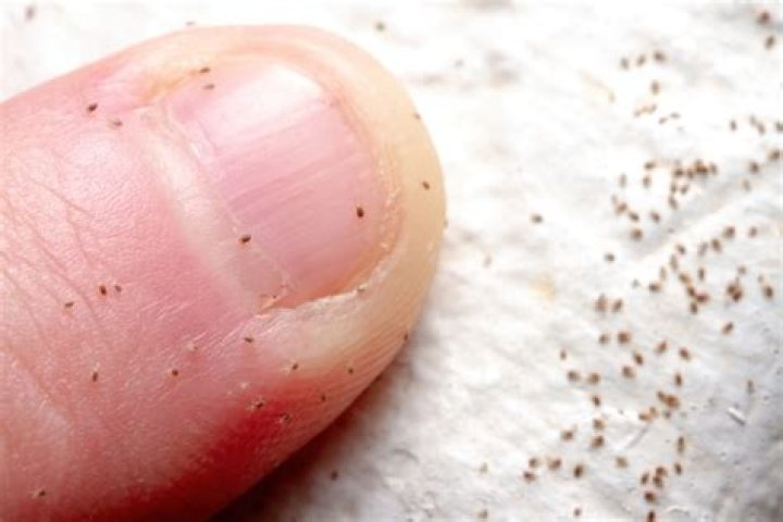 Can Humans Get Mites From Dogs