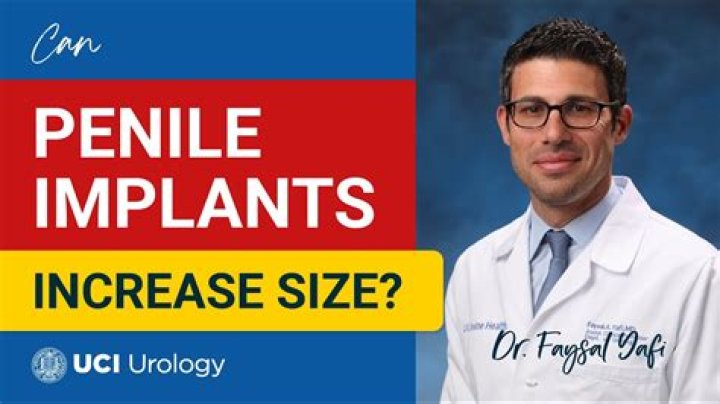 Can penile implants increase size?