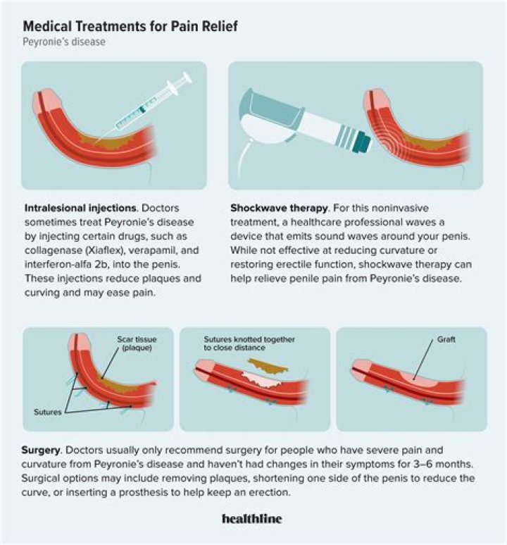 Can peyronies be cured naturally?