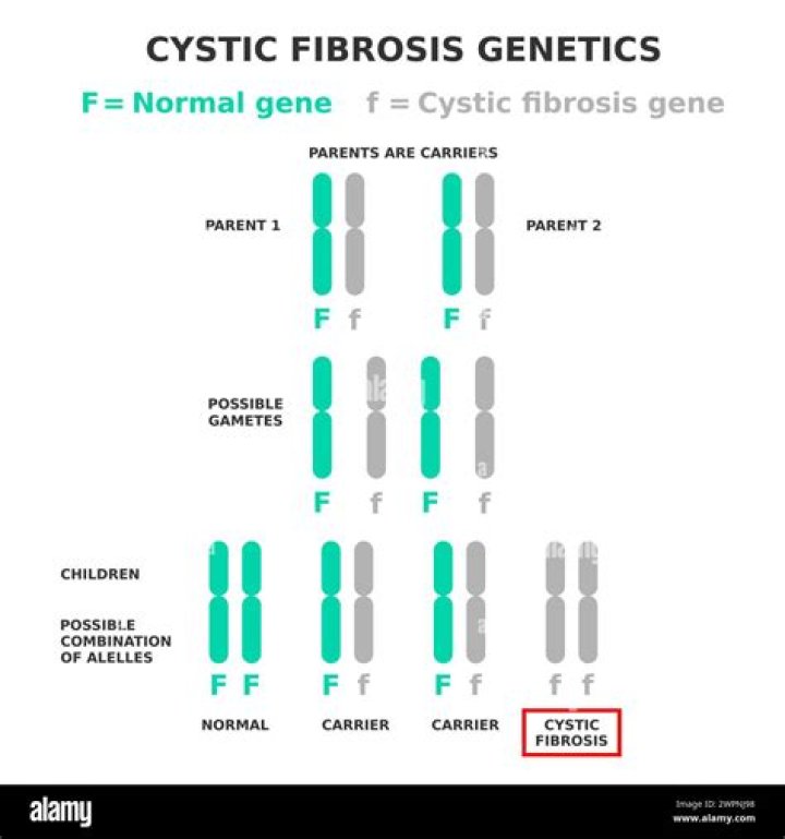 Can you be a carrier of cystic fibrosis and not have it?