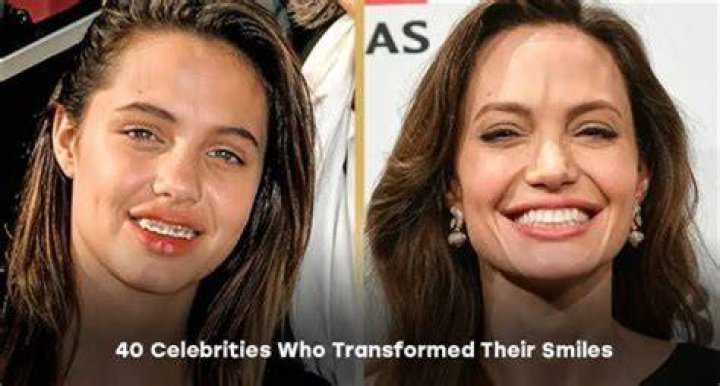 Celebrities Who Transformed Their Skin