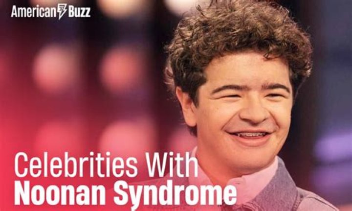 Celebrities with Noonan Syndrome r/GiggleWave