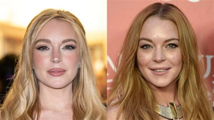 Celebrity Lindsay Lohan plastic surgery, photos, video