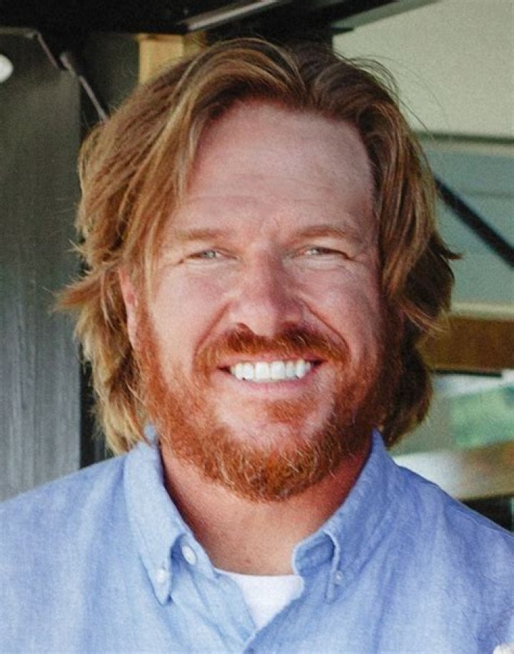 Chip Gaines Teeth Fixed Before And After Teeth Poster