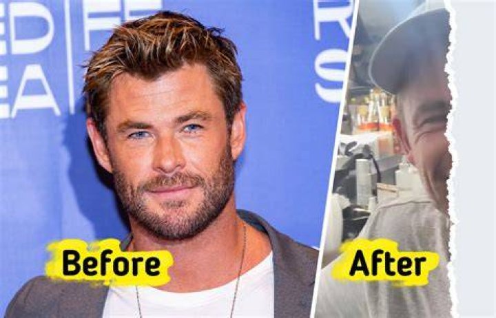 Chris Hemsworth's Plastic Surgery Journey: Unveiling The Truths
