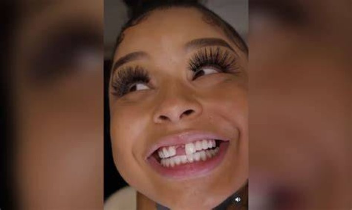 Chrisean Rock Replaces Her Missing Tooth Then Says She Wants "A Gap