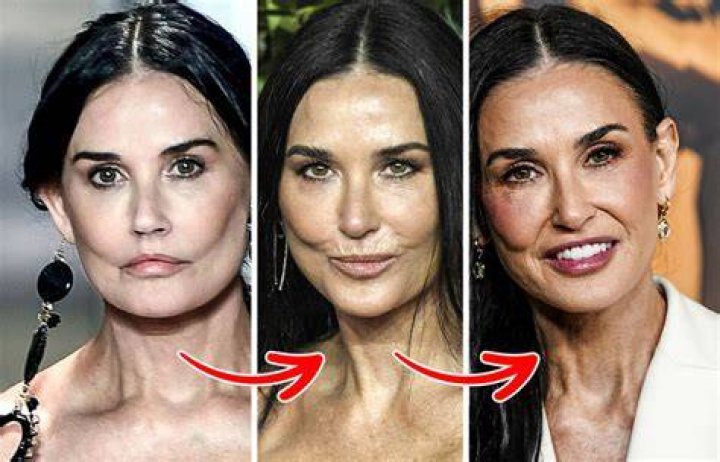 Did She Have Plastic Surgery? What happened to her? |