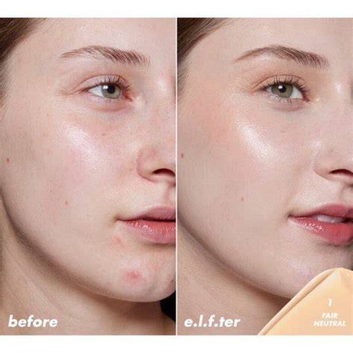 Does Elf Halo Glow Trigger Acne?