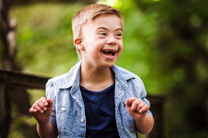 Down Syndrome In The Spotlight