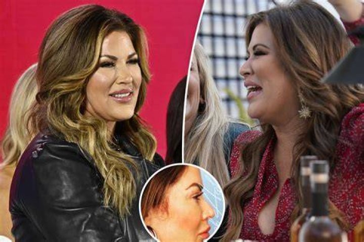Emily Simpson's Facelift Journey Revealed