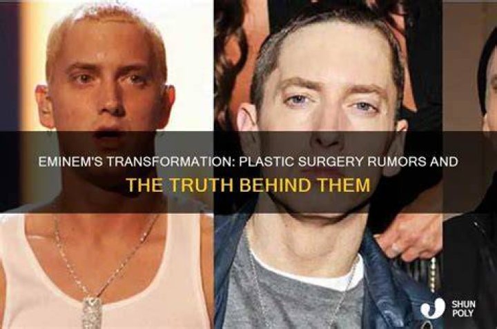 Eminem's Plastic Surgery: Uncovering The Truth