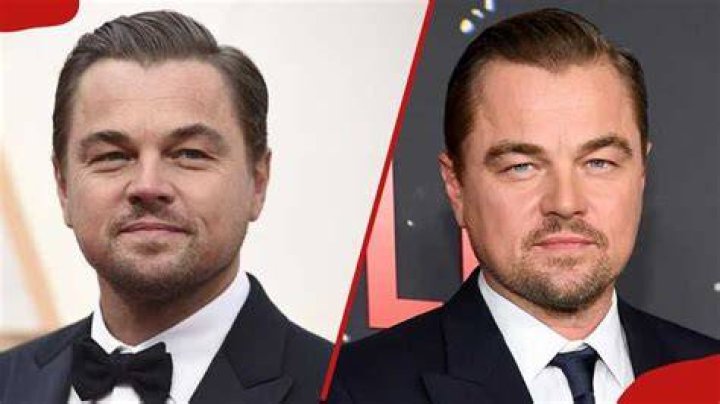 Famous Celebrities With Cleft Lip