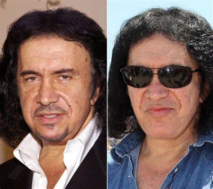 Gene Simmons Plastic Surgery Before and After Facelift Photos Gossip