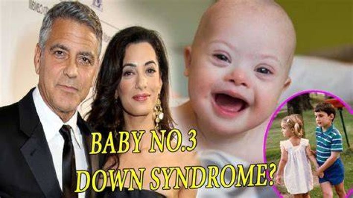 George Clooney's Children And Down Syndrome