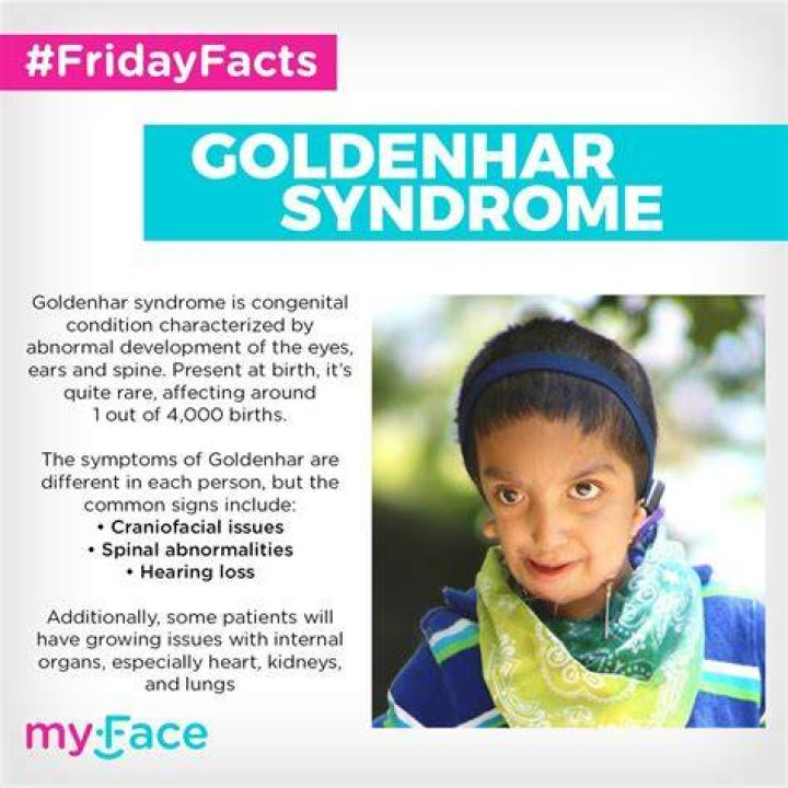Goldenhar Syndrome: Unveiling The Mysteries And Empowering The Journey