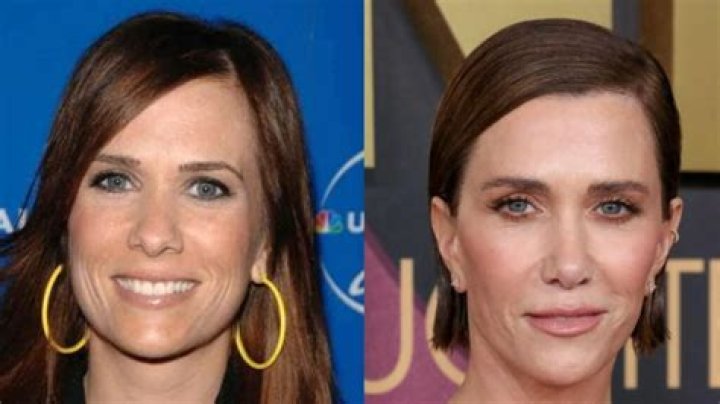 Has Kristen Wiig Has Plastic Surgery? See the Actress’ Transformation