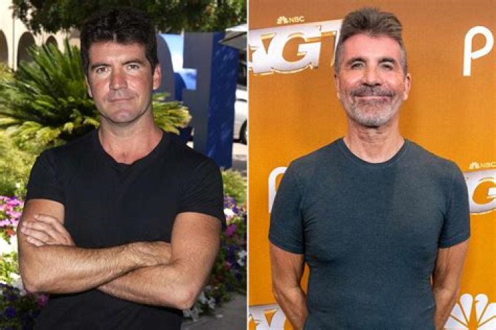 Has Simon Cowell Had Plastic Surgery on His Face? Bizrahmed