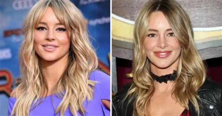 Hassie Harrison Plastic Surgery: Has She Gone Under The Knife?