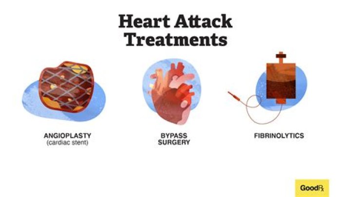 Heart Attack Treatment and Diagnosis Credihealth