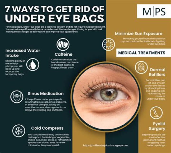 How can I remove Eyebags permanently?