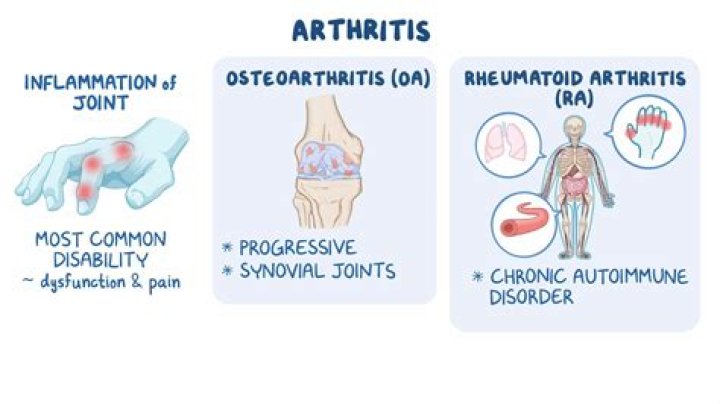How do you know if your child has rheumatoid arthritis?