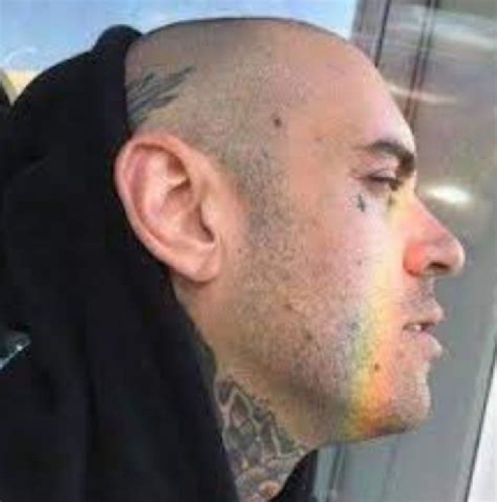 Is Adam22 Bald? Did He Have Hair Transplant? |