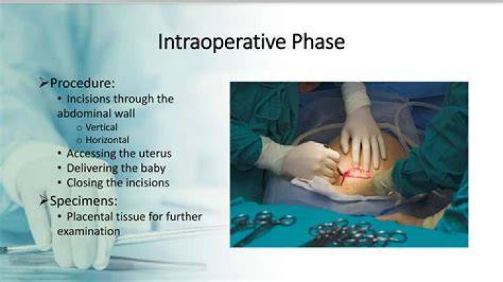 Is C-section surgery painful?