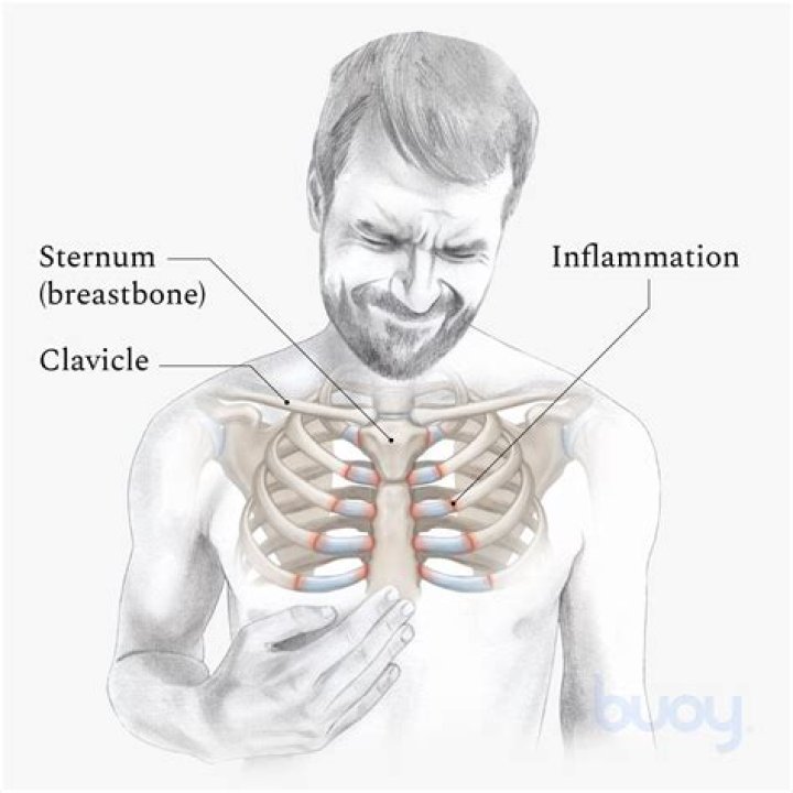 Is sternum pain considered chest pain?