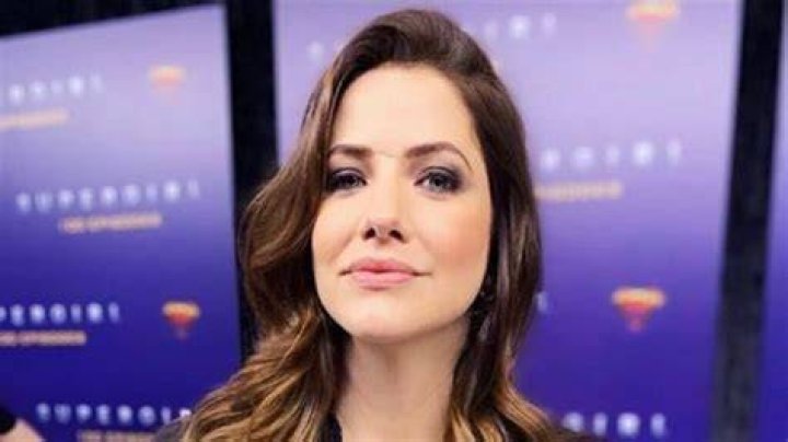 Julie Gonzalo&rsquo;s Scar Birth Mark or What?