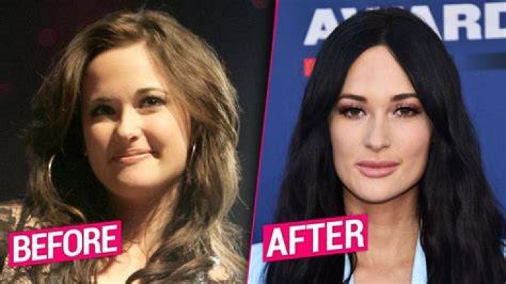 Kacey Musgraves Plastic Surgery Lips, Nose Job, Body Measurements