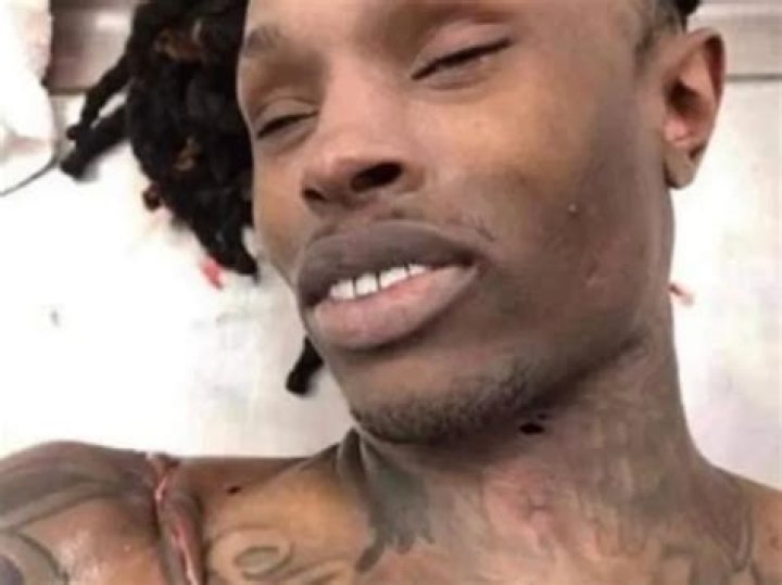 King Von Autopsy Photo