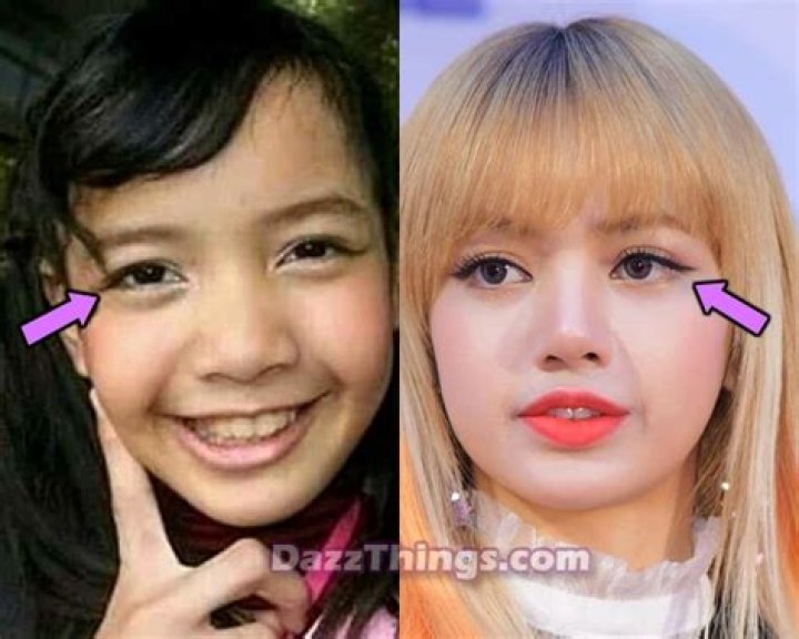 LISA Before Plastic Surgery: Uncovering Her Transformation