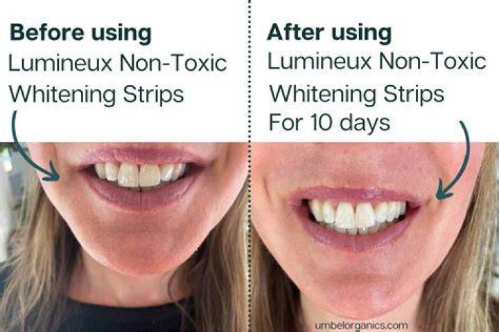 Lumineux Teeth Whitening Strips by Oral Essentials 21 Treatments