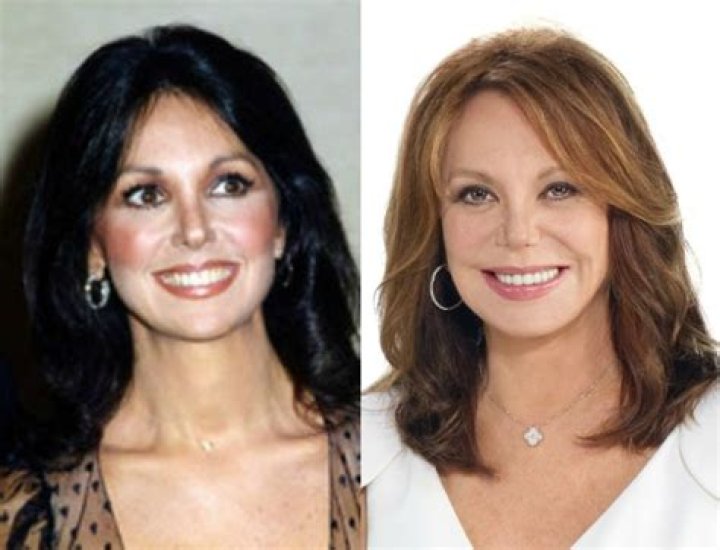 Marlo Thomas Plastic Surgery Could She Be Having One? Marlo thomas