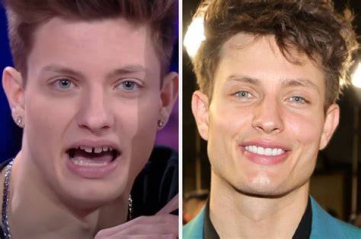 Matt Rife Plastic Surgery And Weight Loss Details Age