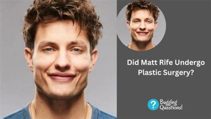 Matt Rife&rsquo;s Plastic Surgery Check Out His Before and After Pictures