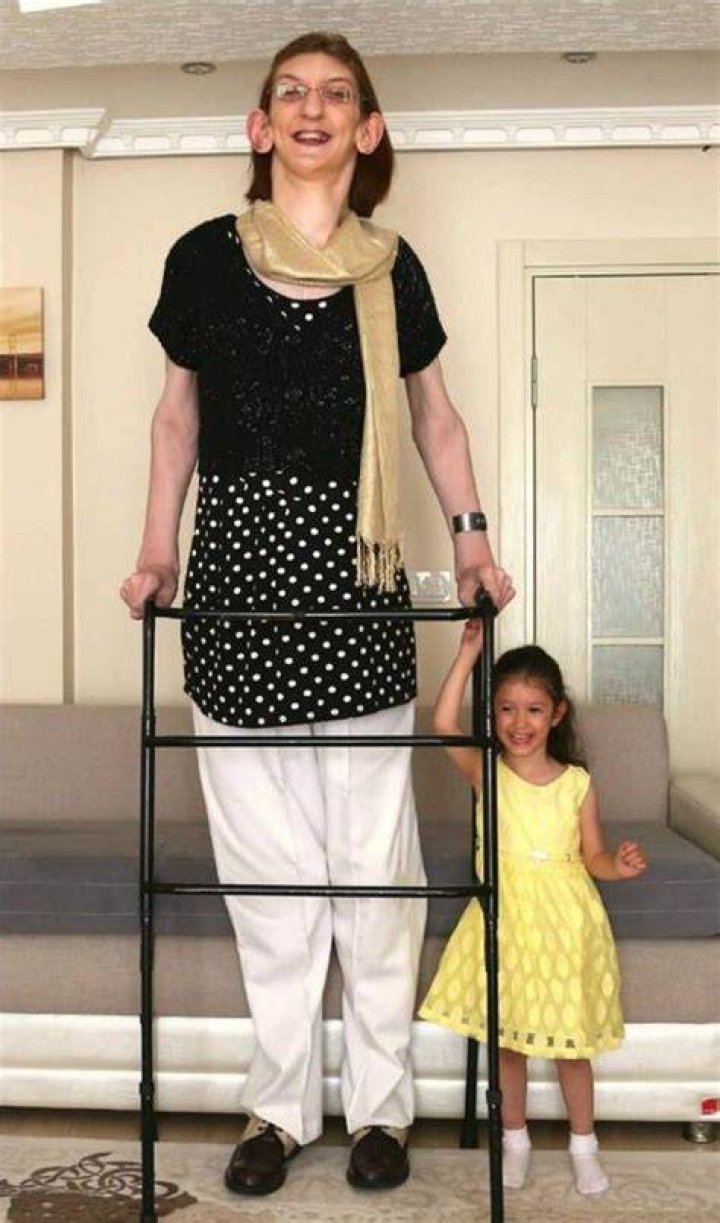 Meet Rumeysa Gelgi, The Worlds Tallest Woman, Whos 7Feet Tall
