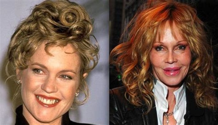 Melanie Griffith on plastic surgery regrets &lsquo;Hopefully, I look more