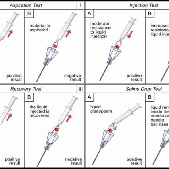 Needle positioning tests Aspiration test aspiration using a 5 ml
