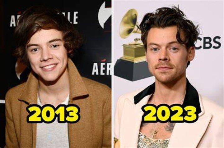 Old Photos Of Harry Styles One Direction Singer's Transformation